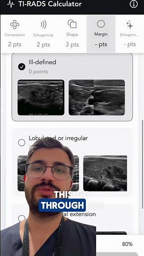 Biopsy or not biopsy? Easy TI-RADS Calculator 📱