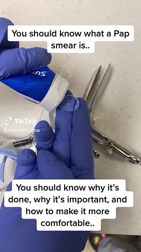 My videos aren’t the problem….. | smear test