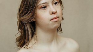 This young model with Down syndrome was featured in Marie Claire Russia