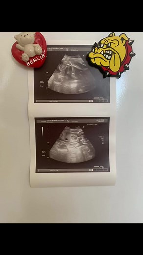 6.2K views · 138 reactions | Childhood’s in American bully Frost camp #americanbully #americanbullypuppy #americanbullypocket #americanbullycamp | Pablo The Bully | Facebook