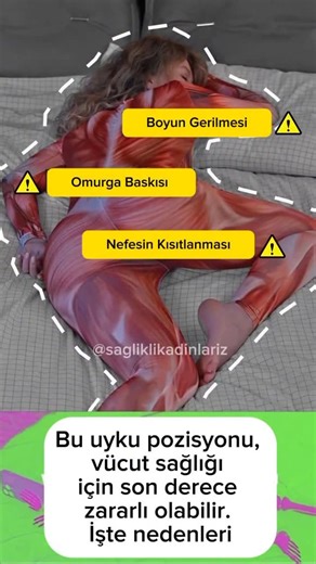 Dr.Gülnar Mahmud 🇹🇷🇦🇿| Bütüncül Kadın Sağlığı & Cinsel Sağlık| on Instagram‎: "💤 Hangi Uyku Pozisyonu Daha Sağlıklı? Yüzüstü mü, Sırtüstü mü? Uyku sırasında vücudun pozisyonu, sadece rahatlıkla değil, iç organların çalışması, hormon dengesi ve cilt sağlığıyla da doğrudan ilgilidir. 🚫 Yüzüstü Uyumak Neden Zararlı? 🔸 Omurga eğriliğini bozar, boyun ve bel ağrısı yapar 🔸 Kalp ve akciğerleri ezer, nefes almayı zorlaştırır 🔸 Mideye baskı yapar, reflü ve şişkinliği artırabilir 🔸 Damarları sık