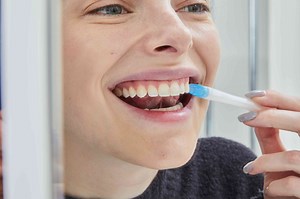 We've Tested Dozens of Teeth Whiteners—These 8 Brightened Our Teeth Two Shades Without Sensitivity