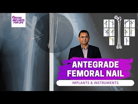 Antegrade Femoral Nail | AFN | Instruments and Uses