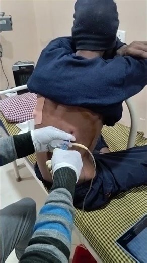 I Punctured My Lung (Thoracentesis Experience)