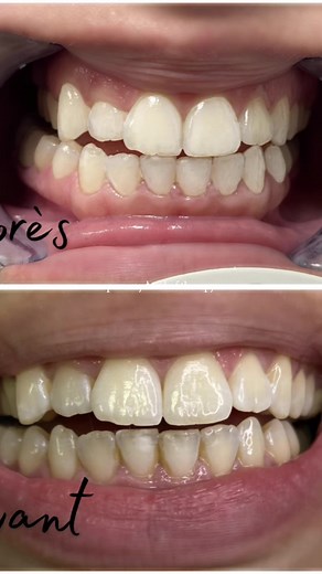 ✨ Offrez-vous une pause bien-être ! ✨ Venez découvrir notre institut de beauté, un lieu dédié à votre détente et à votre beauté. Soins du visage HydraFace, Peeling, Blanchiment dentaireC Browlift... 🌸 Profitez de nos offres spéciales de lancement et laissez-vous chouchouter par nos esthéticiennes expertes. 💆‍♀️ 📍94 #beautysalon #institut #fyp