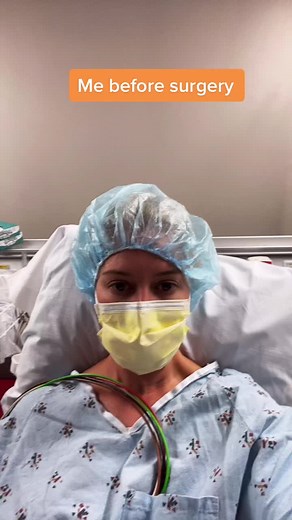 Heidi Montag Plastic Surgery Before and After Transformation