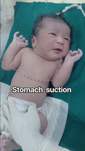 Newborn Baby Belly Button Cleaning | Safe & Gentle Umbilical Cord Care #babysafe #babyontheway #baby
