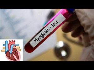 Myoglobin blood test: introduction: Normal range: purpose: Procedure: High and Low causes