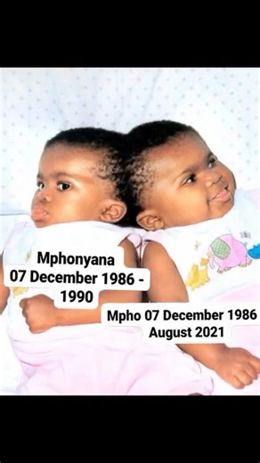 Throwback Thursday | "Mpho le Mphonyana We Love You", South Africa’s First Conjoined Twins #ThrowbackThursday #Jouberton #Klerksdorp #CityofMatlosana #MpholeMphonyanaMathibela By: Maklera Magazine South Africa - On December 7, 1986, at Tshepong Hospital in Jouberton, Klerksdorp, Sophie Mathibela gave birth to South Africa’s first conjoined twins, Mpho and Mphonyana. The twins were joined at the head, sharing a skull, portions of brain tissue, and a major blood vessel—an incredibly rare and compl