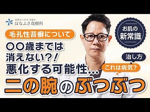 [How to cure bumps on the upper arms] Is lichen pilaris a disease? It may worsen...! Causes and t...