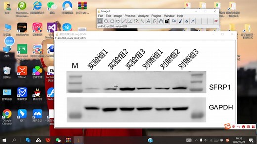 蛋白灰度分析 imageJ Prism的使用 #生命科学综合实验 临床大二医学僧 科研小白可食用-2022-5-21