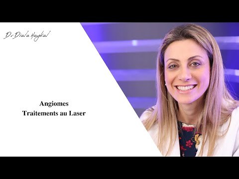 🔴Angiomes Traitements au Laser