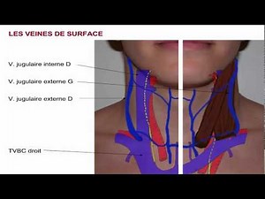 Les vaisseaux du cou