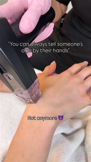 Our hands are one of the first places to show signs of aging; sun exposure, collagen loss, and time all take their toll. ✨ Morpheus8 helps restore firmness, smoothness, and that youthful glow from the inside out. Because your hands deserve anti-aging love too  #Morpheus8 #SkinTightening #MediSpa #YouthfulSkin #AntiAgingHands | Modern Medi Spa | Facebook