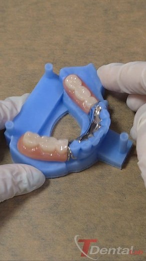 Digital RPD, make it easy ! #removabledenture #digitalrpd #3dprosth | Thailand Dental Lab