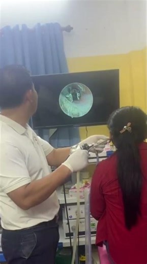 Shocking Earwax Extraction 👂🔍 | Professional Doctor Cleaning #ASMR #HealthTips