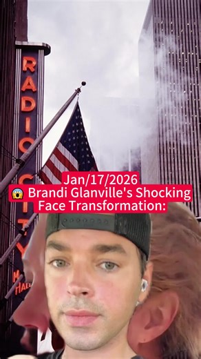 Brandi Glanville's Stunning Face Transformation Explained