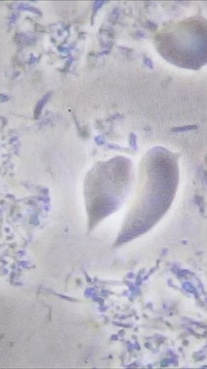 70% of Adults Have THIS Tissue Invasive Bacteria