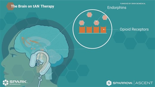 A wearable medical device for opioid withdrawal shows major promise in a 'pivotal' new study