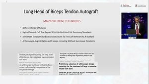 Biceps Augmentation for Large and Massive Rotator Cuff Tear Repair