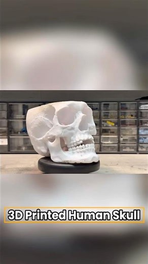 3D Printed Human Skull