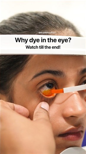 6 Hidden Eye Conditions Revealed By Fluorescein Dye