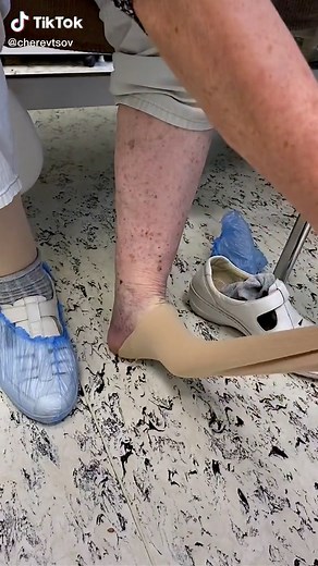 Foot Examination by Healthcare Professional in Medical Setting