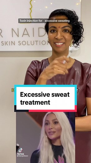 Botulinum toxin injections,(toxin injections) can effectively treat excessive sweating, a condition called hyperhidrosis. Toxin is injected into specific areas with excessive sweating, such as the underarms or palms. The toxin temporarily blocks the nerves that trigger sweat glands, preventing them from producing excessive sweat. As a result, the treated area experiences significantly reduced sweating, often within days to a week. The effects typically last for several months, after which the tr