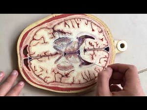 Cross sections of the brain