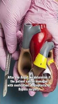 From ECG to Angiogram: The Golden Hour of Heart Attack Treatment