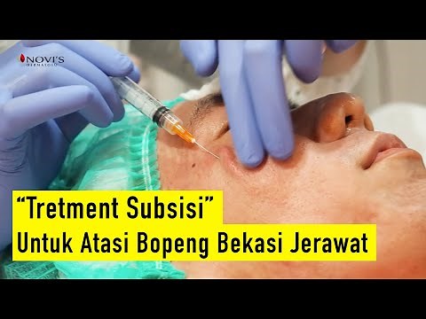Subsisi - Untuk Atasi Bopeng Bekasi Jerawat - NOVI'S Dermatology Clinic