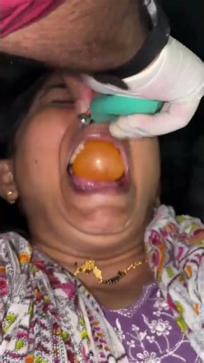 बलून थेरपी