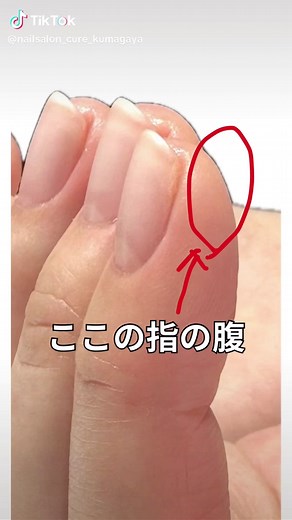 爪の内出血について！内出血性炎症とは？