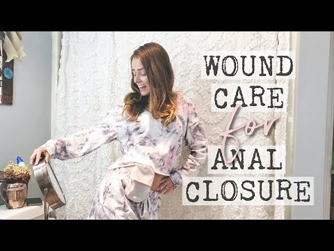 Proctocolectomy Wound Care | Let's Talk IBD