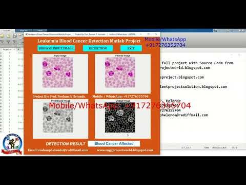 Leukemia Blood Cancer Detection Using Image Processing | With Source Code | Matlab Project Leukemia