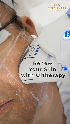 Ultherapy is a non-invasive cosmetic procedure with ultrasound...