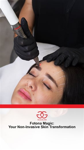 Fotona || UAE on Instagram: "Fotona Laser is the modern facelift—no surgery, no injections. Vector Lift lifts brows, opens eyes, and smooths under-eye lines painlessly. Full-face tightening with zero downtime and clinically proven results. Treat acne, scars, and skin laxity with precision and comfort. Your glow-up starts now—safe, effective, and truly transformative.✨ __ 𝗥𝗜𝗖𝗛𝗠𝗢𝗡𝗗 𝗠𝗘𝗗𝗜𝗖𝗔𝗟 𝗟𝗟𝗖 ‘’ The Official Representative of Fotona in UAE & Oman ‘’ __ 𝘾𝙤𝙣𝙩𝙖𝙘𝙩 𝙐𝙨 𝘄𝘄𝘄