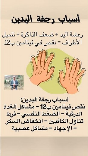 ماهي أسباب رجفة اليدين🤲 #اكسبلور