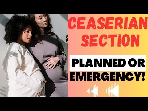 C-SECTION Emergency or Planned, Explained!