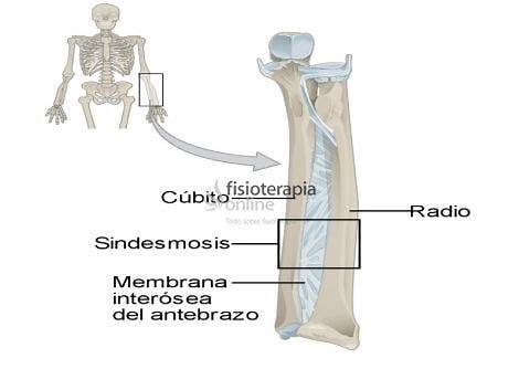 Articulación tipo sindesmosis