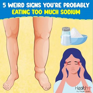 10K views · 155 reactions | 5 Weird Signs You're Probably Eating Too Much Sodium | Health+ | Facebook