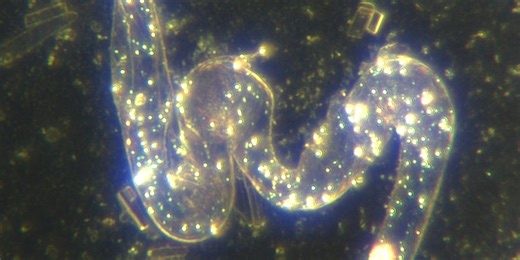 Massive Nano and Microrobot Activity In Pfizer BioN Tech COVID19 injection After 5 Weeks At Room Temperature - Fluorescent Aggregates Found - Darkfield Microscopy