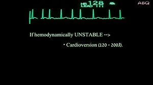 ACLS-ECG Rhythm Recognition and Management