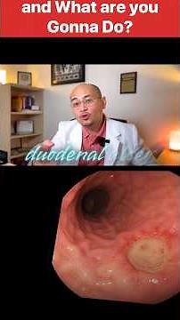 Localizing and Managing GI Bleeds: From Diagnosis to Intervention