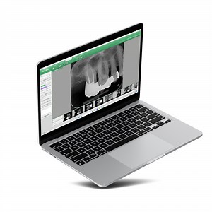 EzDent-i™ - Vatech Europe