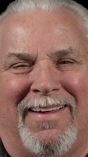 Serving our veterans with dental implants #smiletransformation #dentalimplants #lasvegasdentist