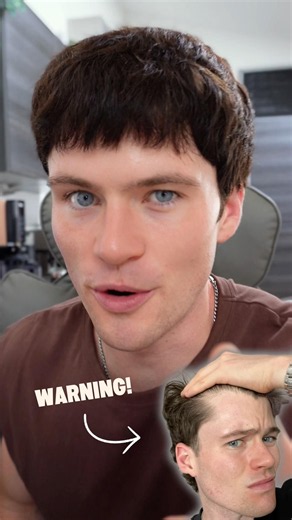 HAIR LOSS WARNING…