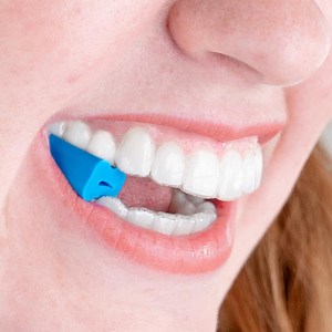 Invisalign™ Aligner Seaters - 2 pack