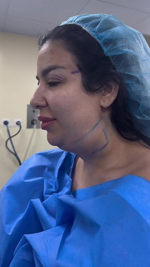 Non-Surgical Face Lift with Lipochin and Eye Lift at Bellaroma Hospital