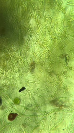 For almost 3 years I’ve been learning how to use a microscope by sampling various aquatic ecosystems. Here’s a compilation of what I’ve found in the last 12 months.1. A mix of bacteria and… | Brittany Baker